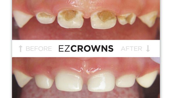 Crowns in San Luis Obispo